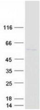 Coomassie blue staining of purified ACTR3 protein.
